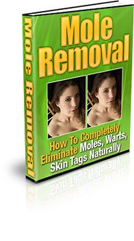 Natural Mole Removal Completely Eliminate Moles, Warts, And Skin Tags 